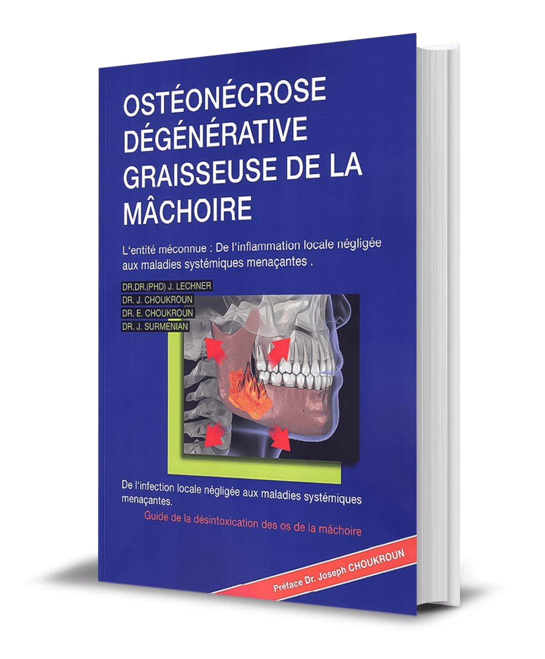 BOOK in French: "Ostéonécrose Cavitaire de l'os de la mâchoire"