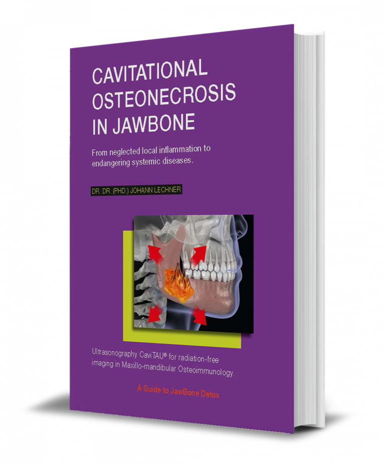 BOOK "Cavitational Osteonecrosis in Jawbone" EN