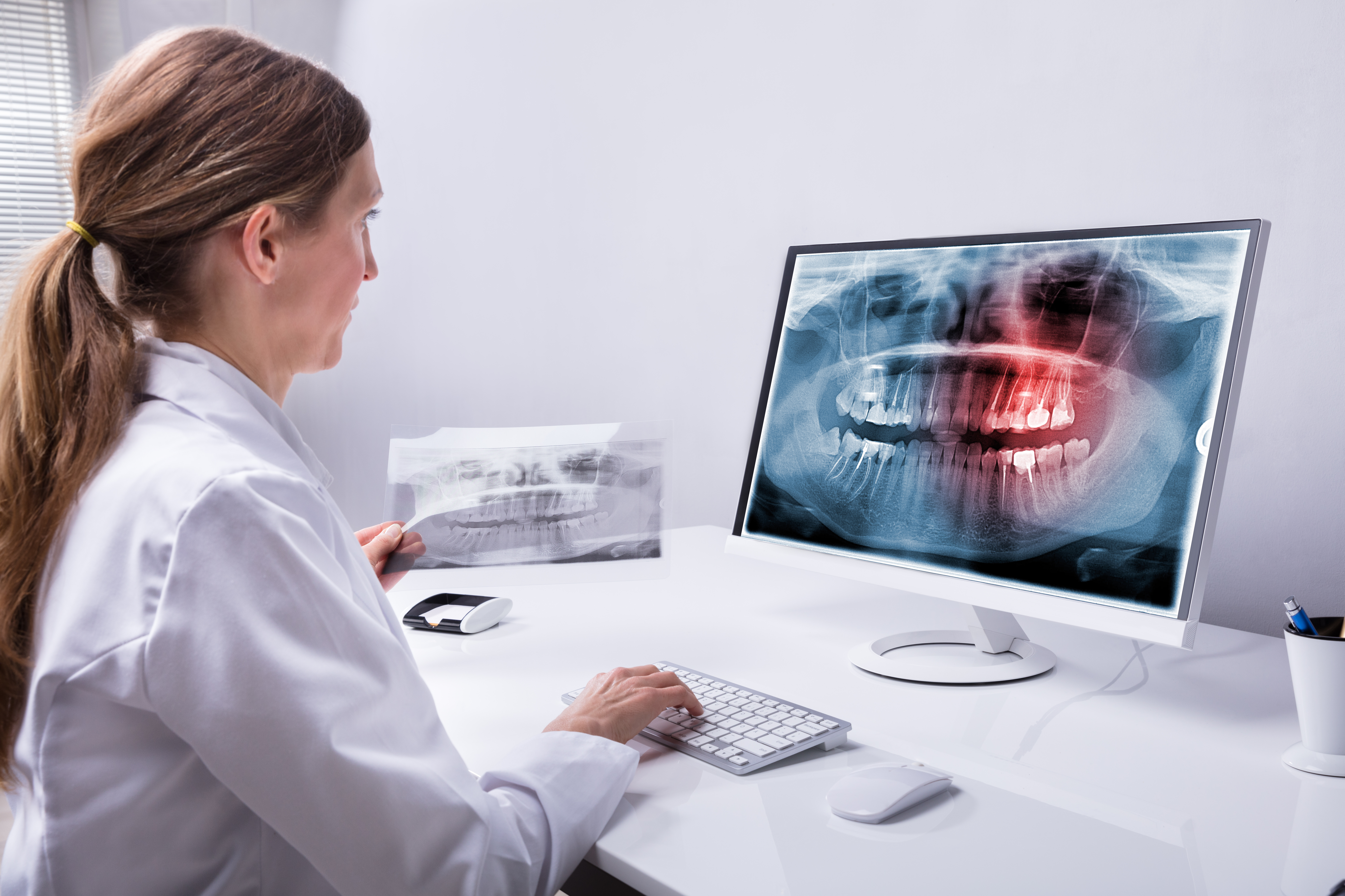 ICOSIM webinar series | Undetected heavy metals in the jaw – physiologically and biochemically dangerous implant sites