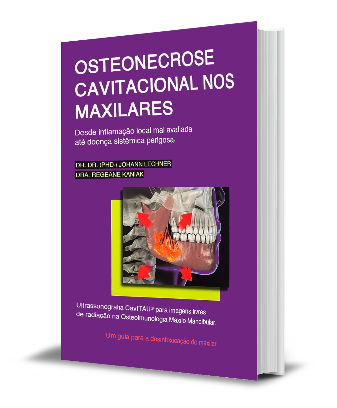BOOK "Osteonecrose Cavitacional nos maxilares" PT