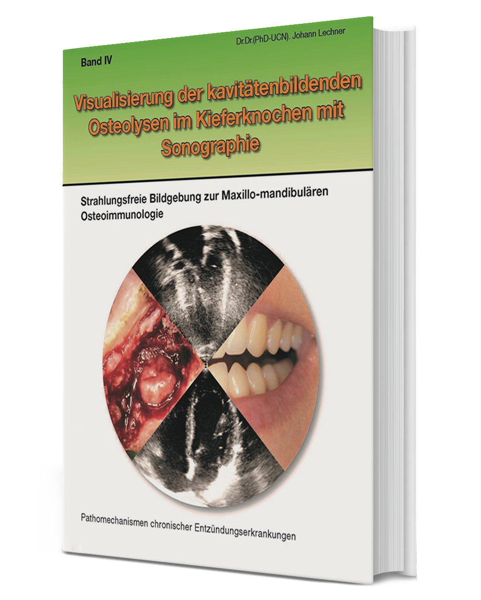 BUCH Band IV "Visualisierung der kavitätenbilden Osteolysen im Kieferknochen mit Sonographie"