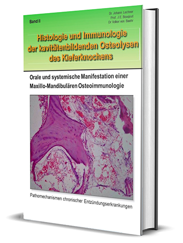 BUCH Band II „Histologie & Immunologie der kavitätenbildenden Osteolysen des Kieferknochens“