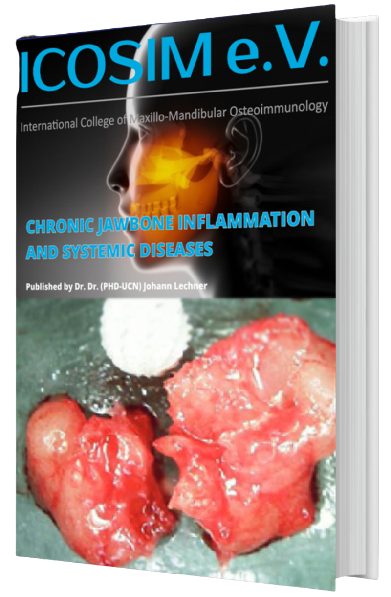 Booklet "Chronic Jawbone Inflammation and Systemic Diseases" EN