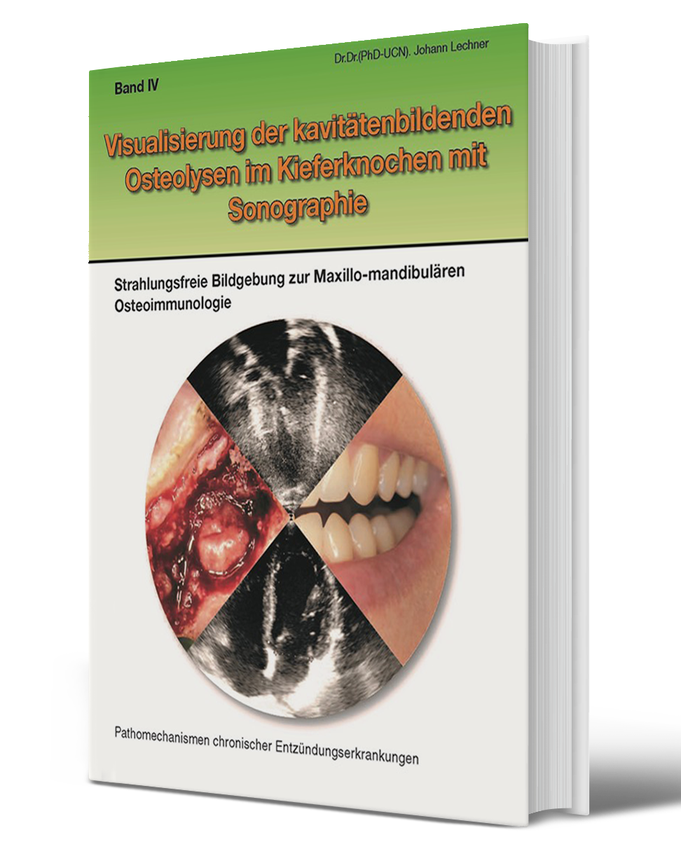 BOOK in German: Volume IV "Visualisation of cavity-forming osteolyses in the jawbone with sonography".