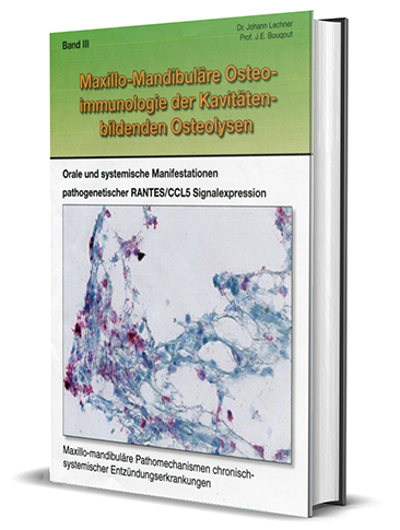 BOOK in German: Volume III "Maxillo-Mandibular Osteoimmunology and Chronic Inflammation in the Maxillary Bone".