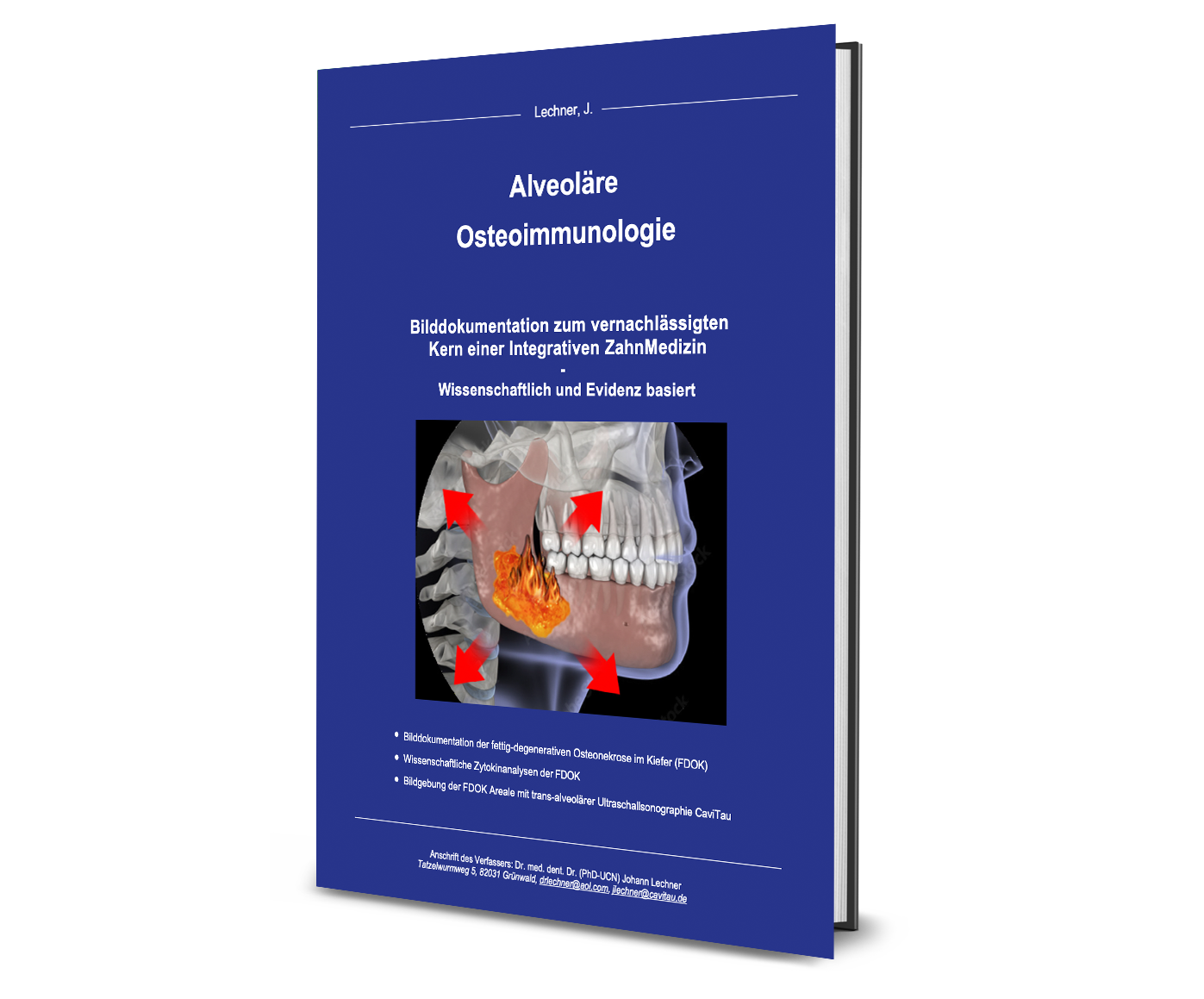 Booklet „Alveoläre Osteoimmunologie“ - neue Bilddokumentation zum vernachlässigten Kern einer Integrativen ZahnMedizin